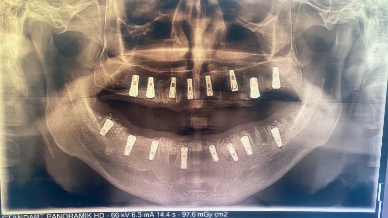 Alanya HEALTHY TEETH Dental Aesthetic — Medicina em Alanya: Encomenda online, preços e comentários